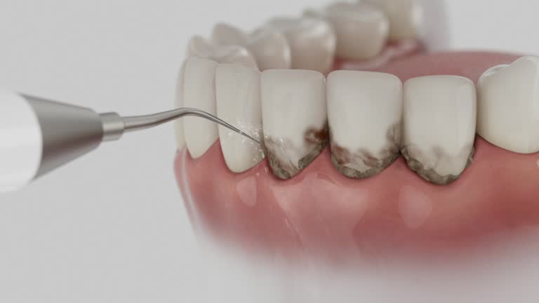 Trusted Teeth Cleaning And Checkup service in Arnold, MD - Dentist Open Now